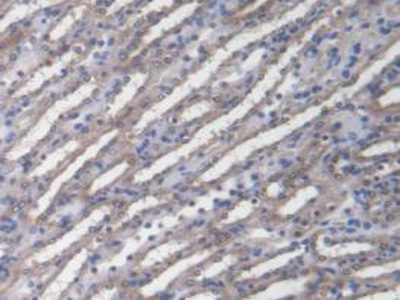 Polyclonal Antibody to Zuotin Related Factor 1 (ZRF1)