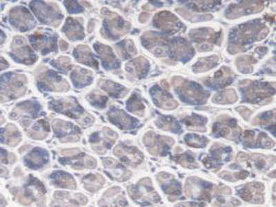 Polyclonal Antibody to Zuotin Related Factor 1 (ZRF1)