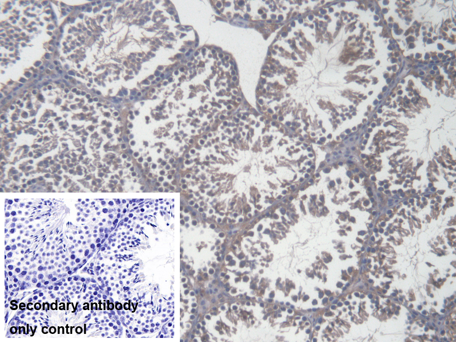 Polyclonal Antibody to Zuotin Related Factor 1 (ZRF1)