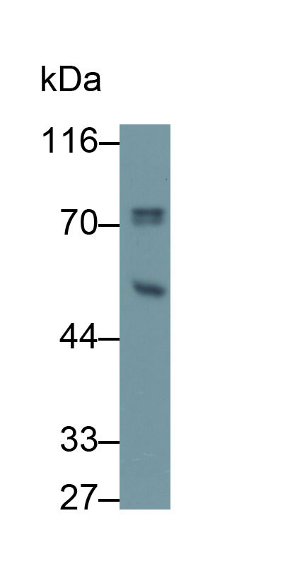 Polyclonal Antibody to Methyl CpG Binding Protein 2 (MECP2)