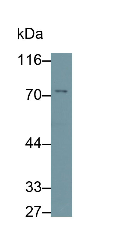 Polyclonal Antibody to Methyl CpG Binding Protein 2 (MECP2)