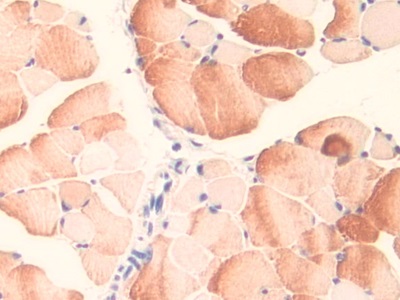 Polyclonal Antibody to Midline 1 (MID1)