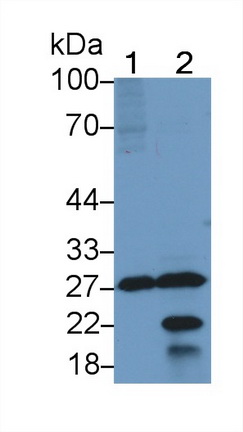 Polyclonal Antibody to Molybdenum Cofactor Synthesis 1 (MOCS1)