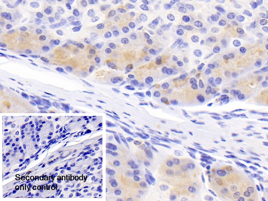 Polyclonal Antibody to Molybdenum Cofactor Synthesis 1 (MOCS1)