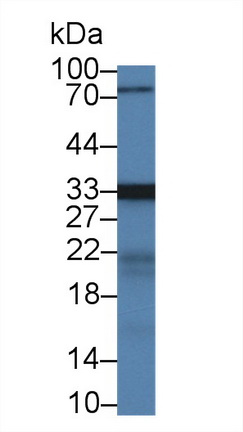 Polyclonal Antibody to 3-Mercaptopyruvate Sulfurtransferase (MST)