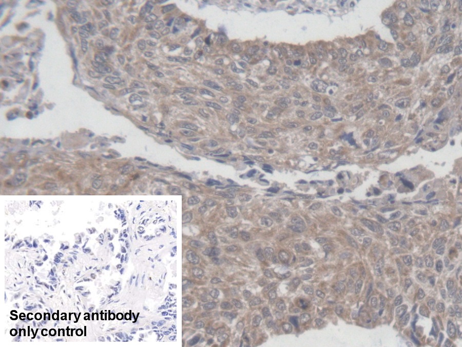 Polyclonal Antibody to Mitochondrial Ribosomal Protein L1 (MRPL1)