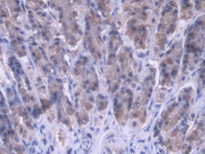 Polyclonal Antibody to Mitochondrial Ribosomal Protein L1 (MRPL1)