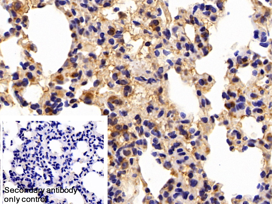 Polyclonal Antibody to Microseminoprotein Beta (MSMb)