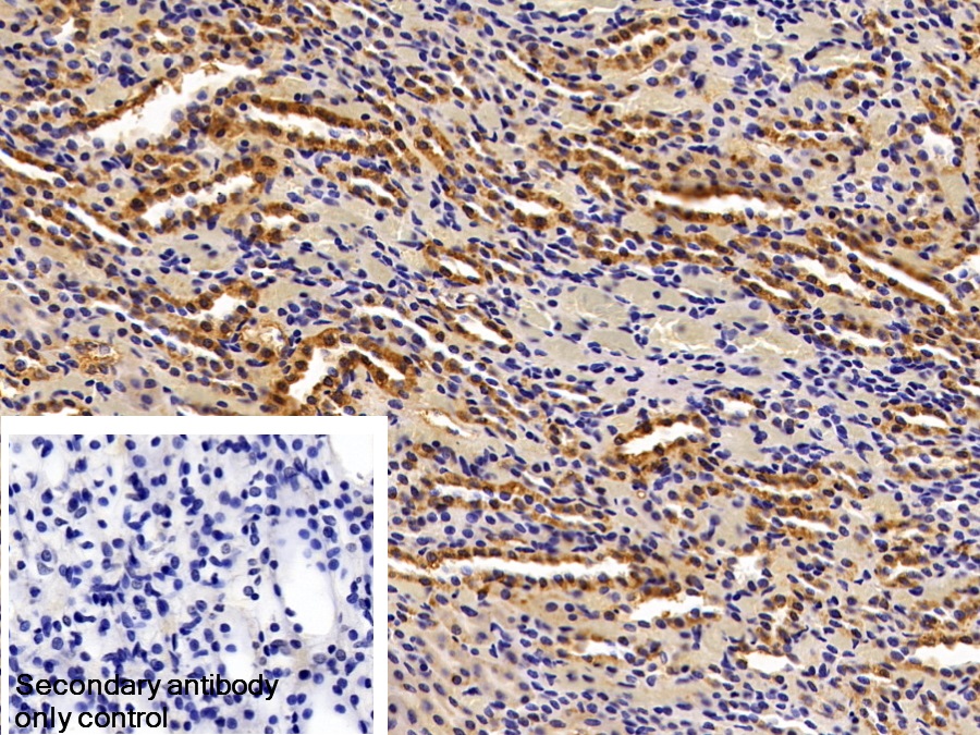 Polyclonal Antibody to Microseminoprotein Beta (MSMb)