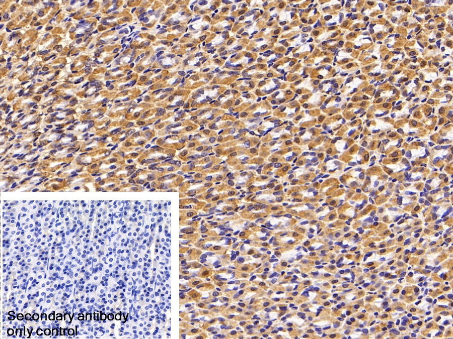 Polyclonal Antibody to Microseminoprotein Beta (MSMb)