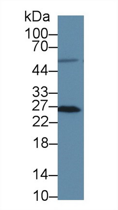 Polyclonal Antibody to Methionine Sulfoxide Reductase A (MSRA)