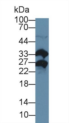 Polyclonal Antibody to Methionine Sulfoxide Reductase A (MSRA)