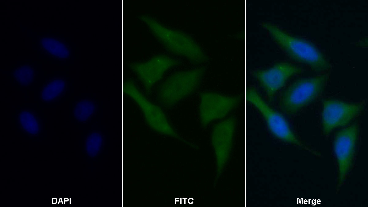 Polyclonal Antibody to Methionine Sulfoxide Reductase A (MSRA)