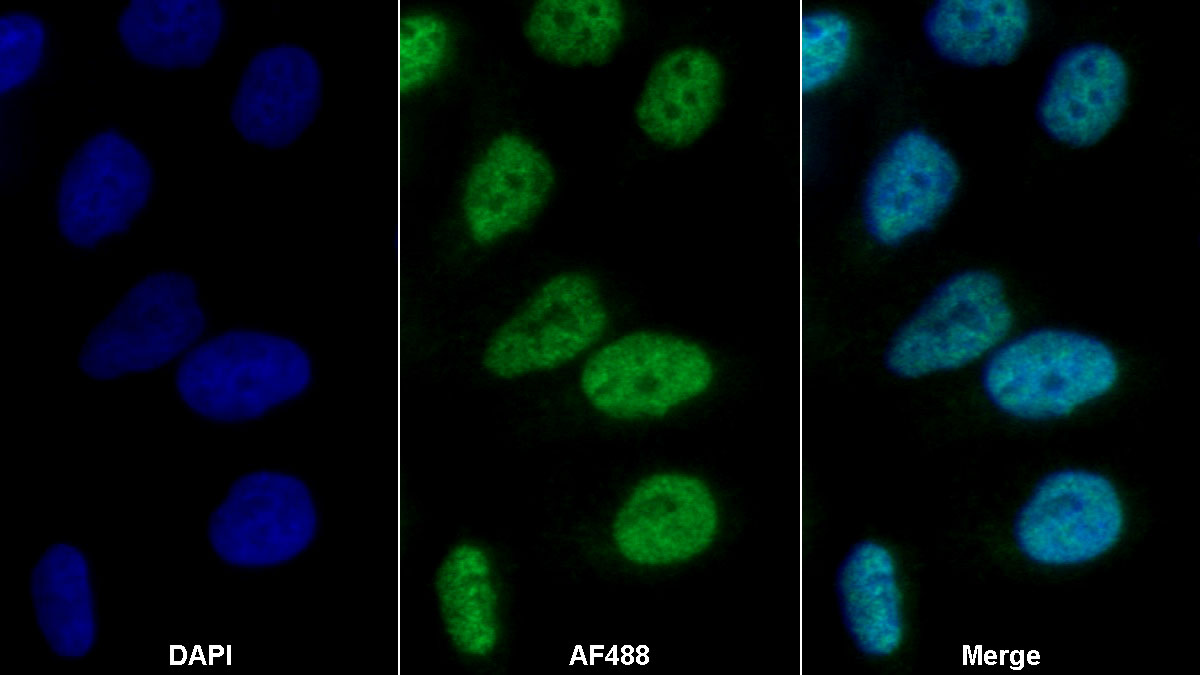 Polyclonal Antibody to Methionine Sulfoxide Reductase A (MSRA)