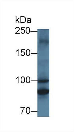 Polyclonal Antibody to Mitochondrial Translational Initiation Factor 2 (MTIF2)