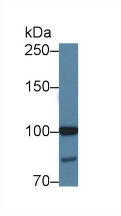 Polyclonal Antibody to Mitochondrial Translational Initiation Factor 2 (MTIF2)