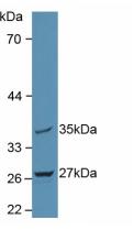 Polyclonal Antibody to Mitochondrial Tumor Suppressor 1 (MTUS1)