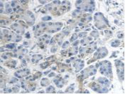 Polyclonal Antibody to Mitochondrial Tumor Suppressor 1 (MTUS1)