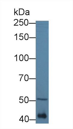 Polyclonal Antibody to Mitochondrial Tumor Suppressor 1 (MTUS1)