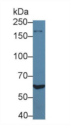 Polyclonal Antibody to Mitochondrial Tumor Suppressor 1 (MTUS1)