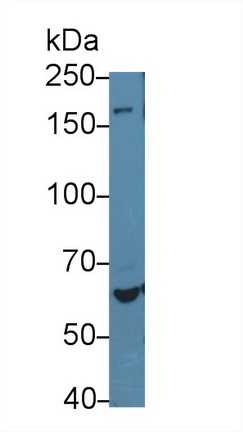 Polyclonal Antibody to Mitochondrial Tumor Suppressor 1 (MTUS1)