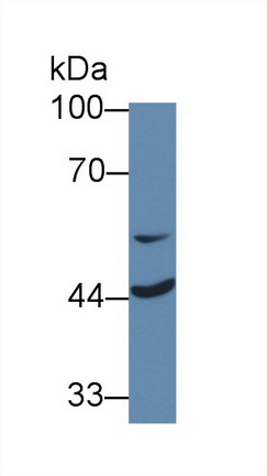 Polyclonal Antibody to Mitochondrial Tumor Suppressor 1 (MTUS1)