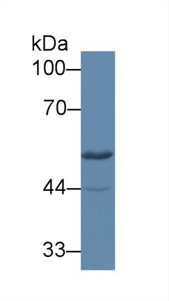 Polyclonal Antibody to Mitochondrial Tumor Suppressor 1 (MTUS1)