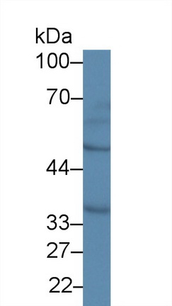 Polyclonal Antibody to Metaxin 1 (MTX1)