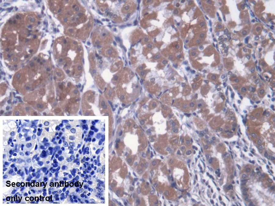 Polyclonal Antibody to Metaxin 1 (MTX1)