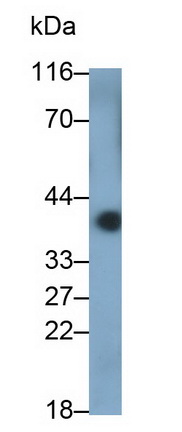 Polyclonal Antibody to Metaxin 1 (MTX1)