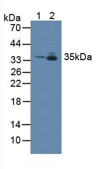 Polyclonal Antibody to Metaxin 1 (MTX1)