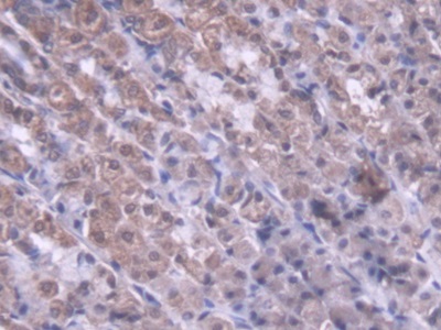 Polyclonal Antibody to Metaxin 1 (MTX1)