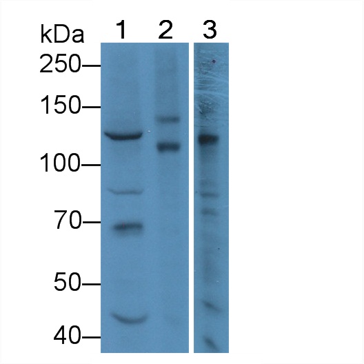 Polyclonal Antibody to Myelin Transcription Factor 1 (MYT1)