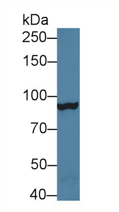 Polyclonal Antibody to Microsomal Triglyceride Transfer Protein (MTTP)