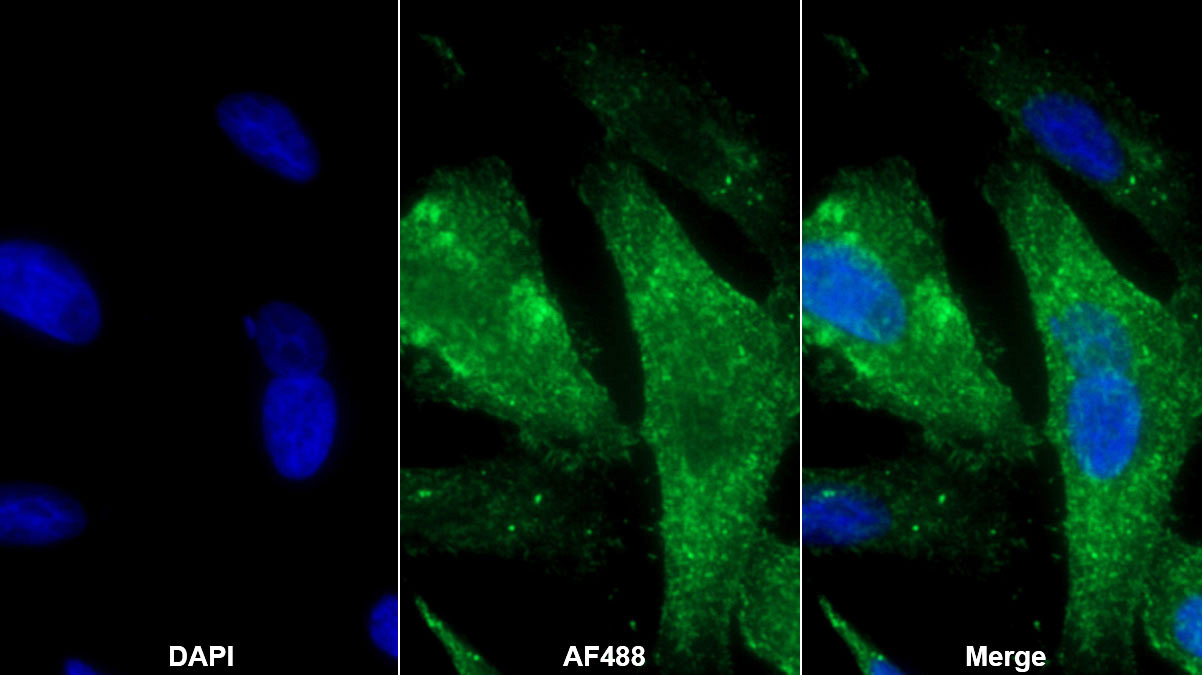 Polyclonal Antibody to Moesin (MSN)