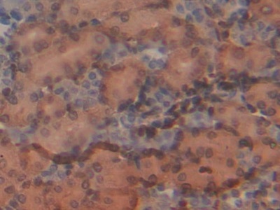 Polyclonal Antibody to Moesin (MSN)