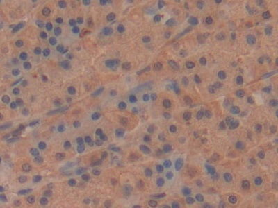 Polyclonal Antibody to Moesin (MSN)