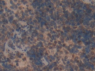 Polyclonal Antibody to Moesin (MSN)