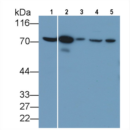 Polyclonal Antibody to Moesin (MSN)