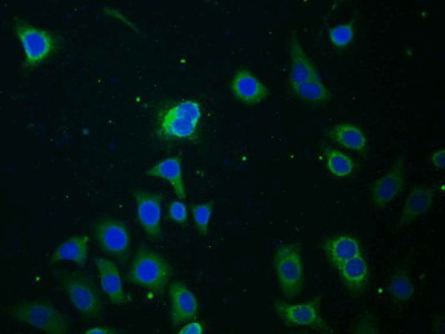 Polyclonal Antibody to Monoamine Oxidase B (MAOB)