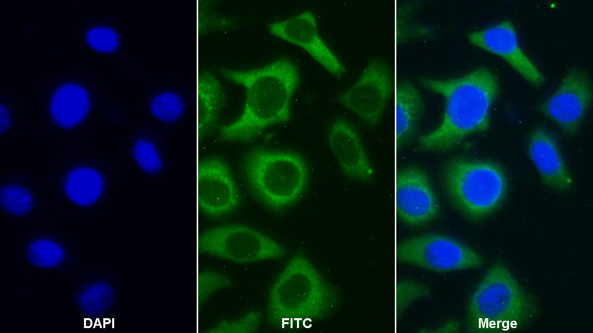 Polyclonal Antibody to Monoamine Oxidase B (MAOB)