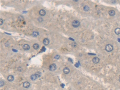 Polyclonal Antibody to N-Ethylmaleimide Sensitive Factor (NSF)