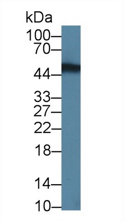 Polyclonal Antibody to Neuro Oncological Ventral Antigen 1 (NOVA1)