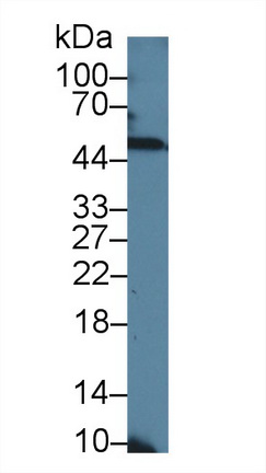 Polyclonal Antibody to Neuro Oncological Ventral Antigen 1 (NOVA1)