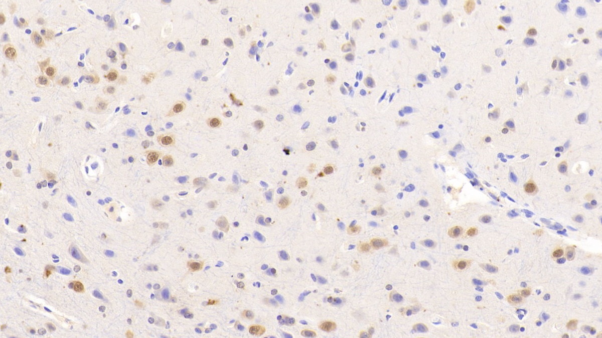 Polyclonal Antibody to Neuro Oncological Ventral Antigen 1 (NOVA1)