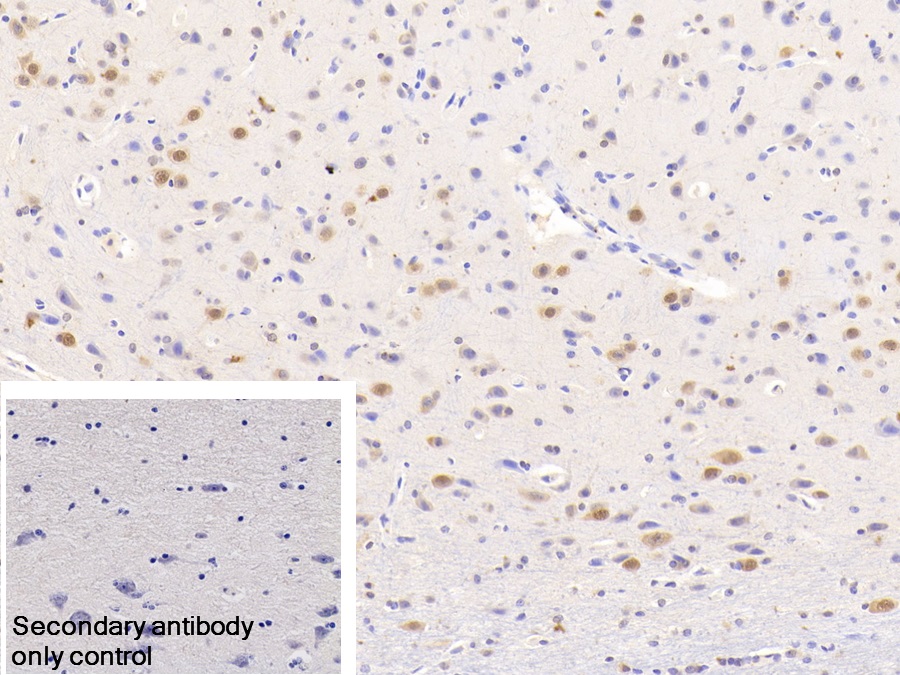 Polyclonal Antibody to Neuro Oncological Ventral Antigen 1 (NOVA1)