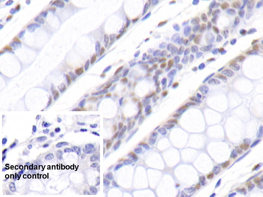 Polyclonal Antibody to Nucleophosmin 1 (NPM1)