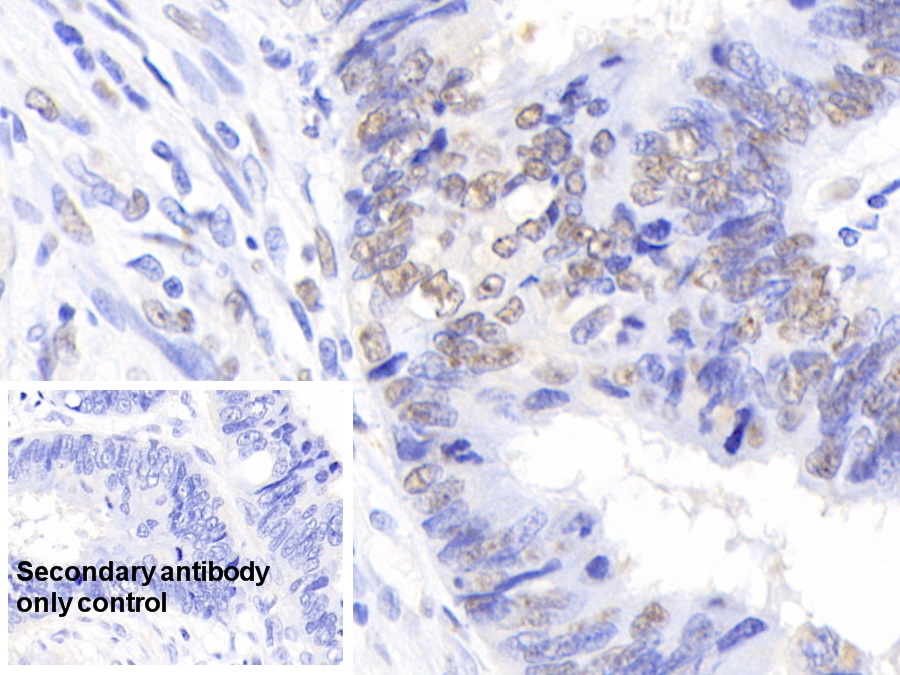 Polyclonal Antibody to Nucleophosmin 1 (NPM1)