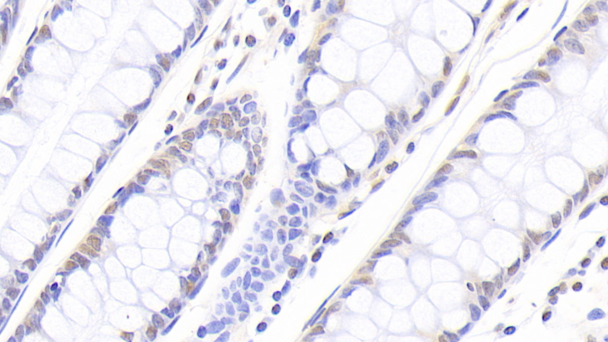 Polyclonal Antibody to Nucleophosmin 1 (NPM1)