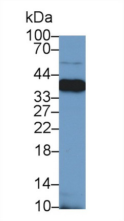 Polyclonal Antibody to Nucleophosmin 1 (NPM1)